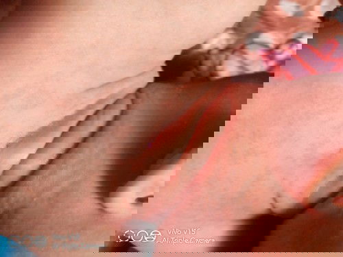 น้องขึ้นผื่นแดง