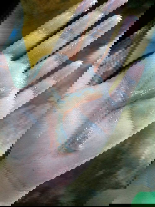 ท้องได้38วีค มีแบบนี้คืออะไรค่ะ