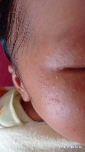 Obat beruntus yang baik untuk bayi