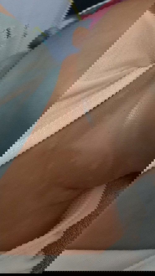 Mga moms normal lng po ba yan sa leeg ni baby kapag laging nababasa ng gatas, 43 day plng ng baby ko