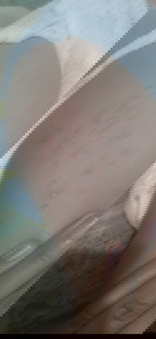 Bintik-bintik banyak ada yg sama? Bagaimana mengatasi?