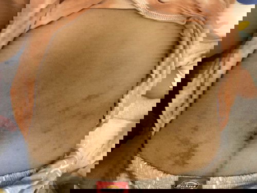 Tummy after delivery