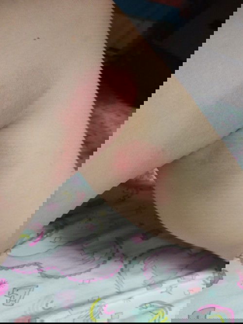 meron na po ba naka experience sa inyo ng ganito? ano po pwede gawin? tia