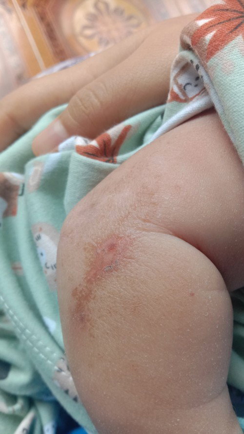 Bayi 2 bulan 3 minggu