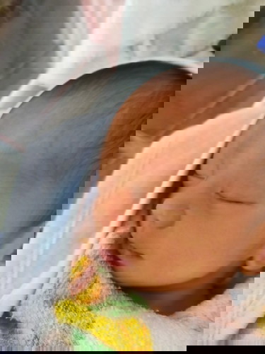 คลอดก่อนกำหนด ภาวะครรภ์เป็นพิษขั้นรุนแรง