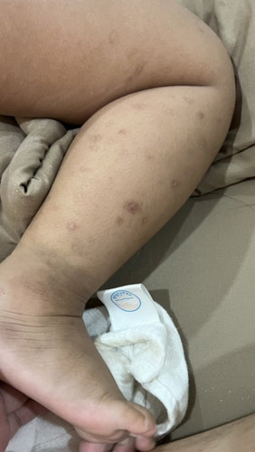 ตัวเล็กขาลายใช้อะไรดีคะ🥺