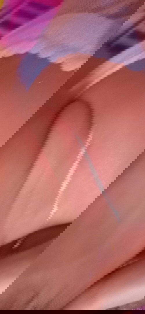 Berengen pd leher bayi