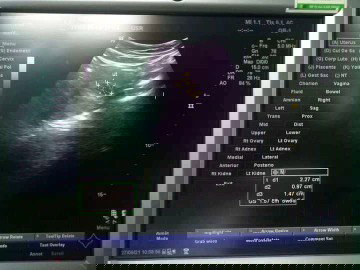 Tentang janin dlm kandungan