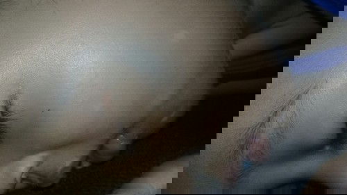 bercak putih di pipi