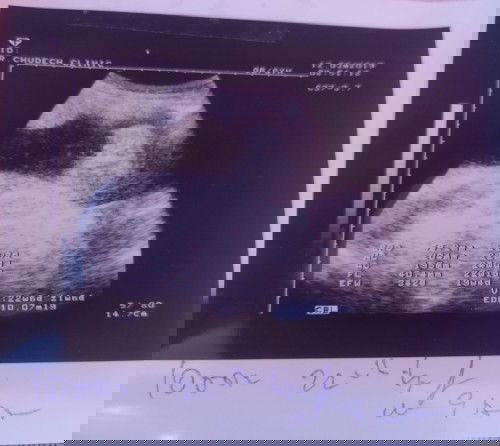 ภาพซาวด์เเบบนี้ผู้หญิงหรือผู้ชายคะ
ตอนนี้23wเเล้วจ้า