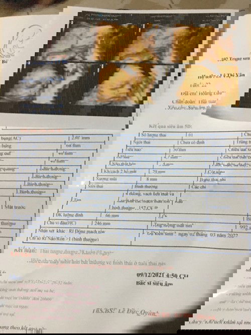 Hỉ ý kiến của các mom