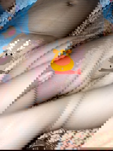 Iritasi pada selangkangan