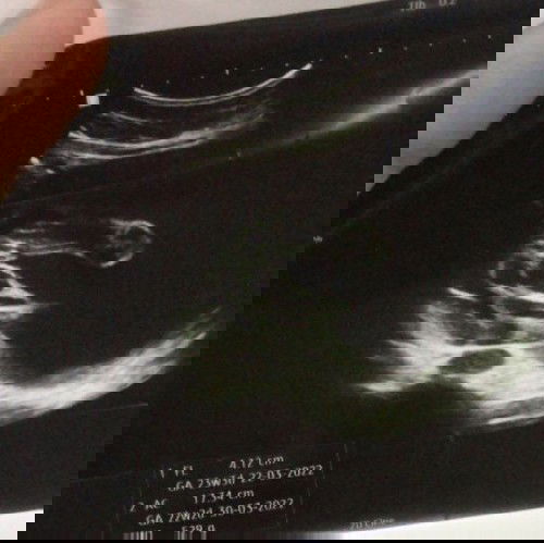 แม่ๆว่าน้องเป็นผู้หญิงหรือผู้ชายคะ