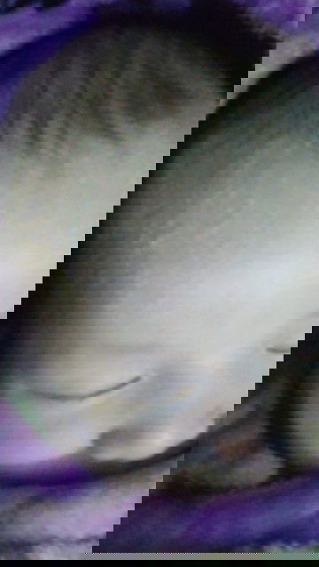 Bun,anak saya baru umur satu minggu, tpi d area jidat sama kepala ada bintik kaya berair ..