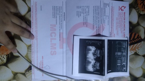 PATULONG PO KUNG MAY DOCTOR PO DITO