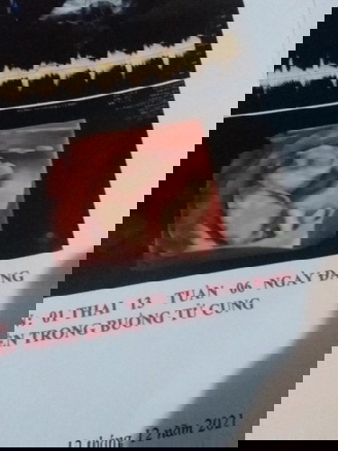 Siêu am 5D 14w chính xác giới tính k may mon.
