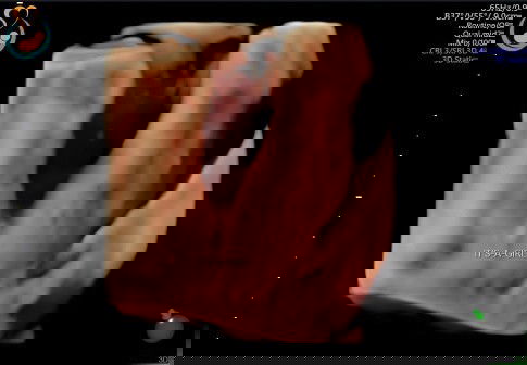 Jl perempuan apakah bisa berubah di usia 22 Minggu...