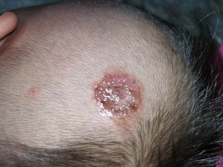 Please help nyo baby ko kung anong gamot nito mahal kasi consultation sa doctor.