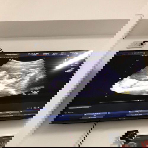 ผู้หญิงหรือผู้ชาย