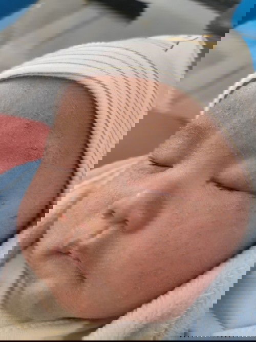 น้องเป็นผื่นตามใบหน้าหัวตัว แล้วก้มีน้ำใสๆพอแห้งก้อเป็นสีเหลืองเสก็ดๆแบบนี้มีวิธีรักษาหรือยาตัวไหนดี