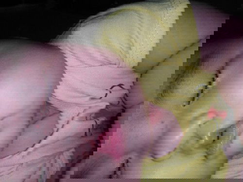 Bé em 4thg mấy mà cổ cứ bị đỏ đó là bị gì v cac mom