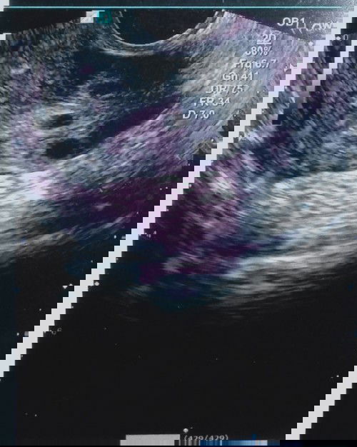 Tespeck masih negatif