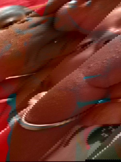 Muncul bintik-bintik kecil di tangan