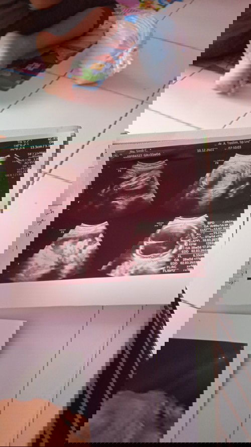 Ingin tahu bund bantu sharing dong