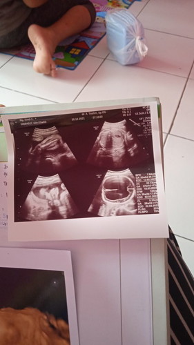 Ingin tahu bund bantu sharing dong