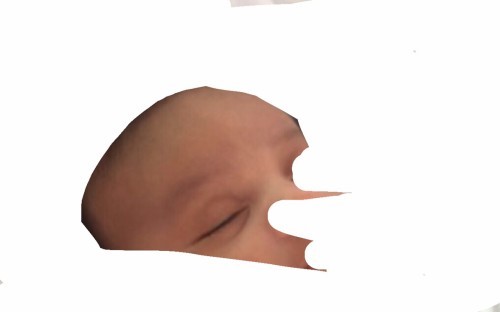 hello! balat po kaya yung nasa forehead ni LO? kung balat po lumalaki at umiitim po kaya yan? o nawawala din? thank you