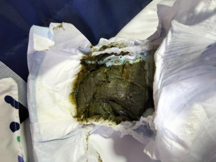 Green watery poop from baby My baby girl is currently on Sim