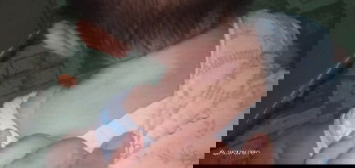 Sino PO dto kmuka sa anak ko may kulay puti tapos lumalaki napansin ko sya 4days pa lng UNG anak ko