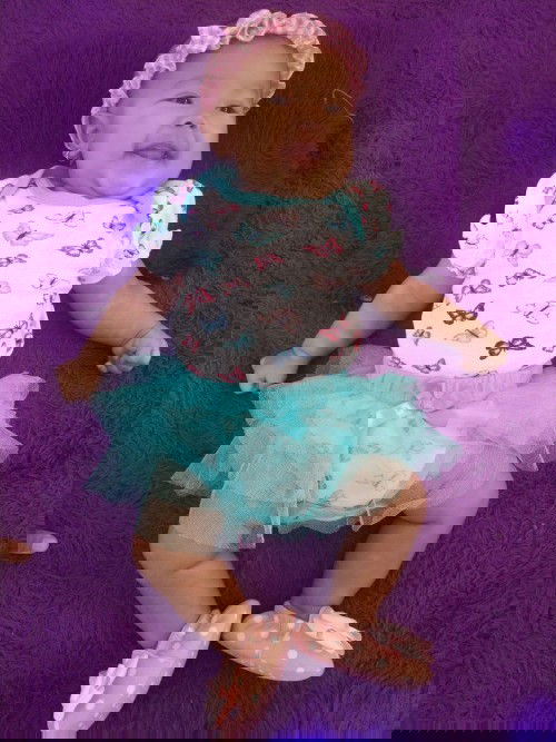 Kulit putih kaya panu