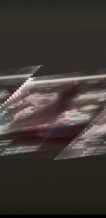 Ano po gender ito babae or lalaki  sabi po kc lalaki po dw