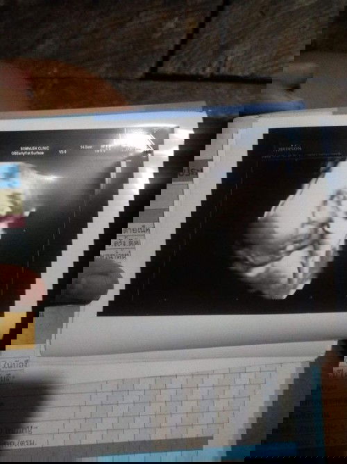 ถามแม่ๆหน่อยคะ