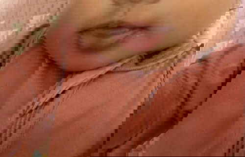 Bibir bawah tengah bayi 4,5 bulan agak biru keunguan