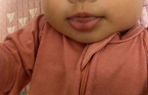Bibir bawah tengah bayi 4,5 bulan agak biru keunguan