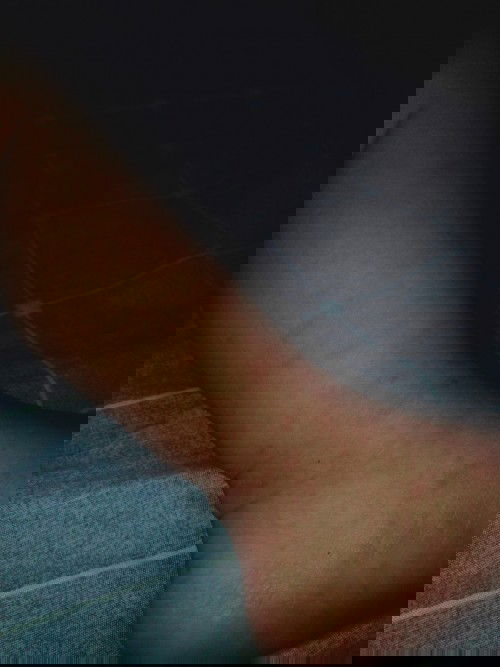 Hand foot mouth disease