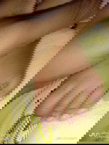 bintik berair
