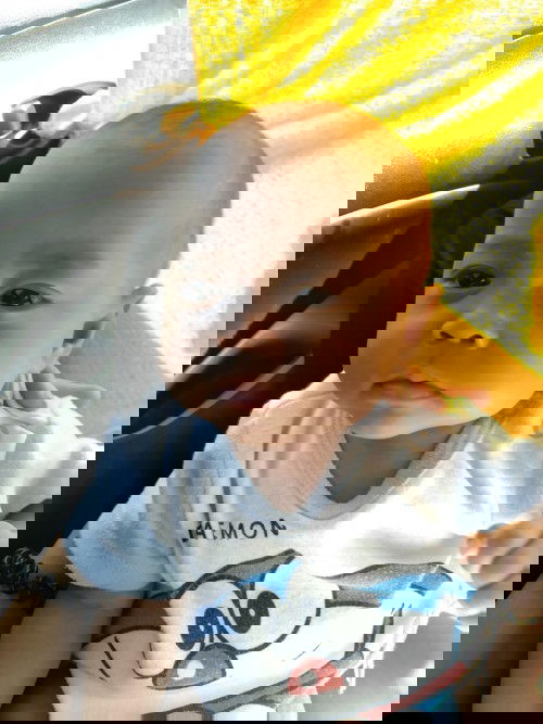 เด็กคลอดก่อนกำหนด28+2