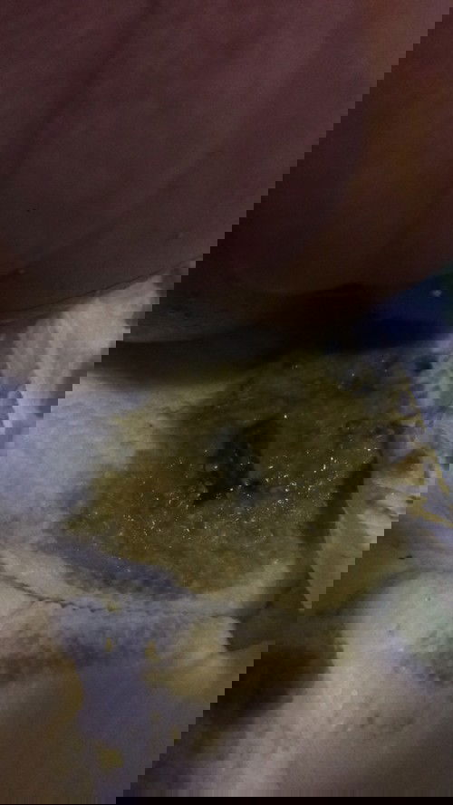 hello po mga mamsh normal lang po ba ganyan poops ni baby watery  tapos may mga nalabas sakanya sinasabi nila na TAON