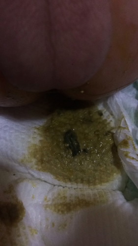 hello po mga mamsh normal lang po ba ganyan poops ni baby watery tapos may mga nalabas sakanya sinasabi nila na TAON