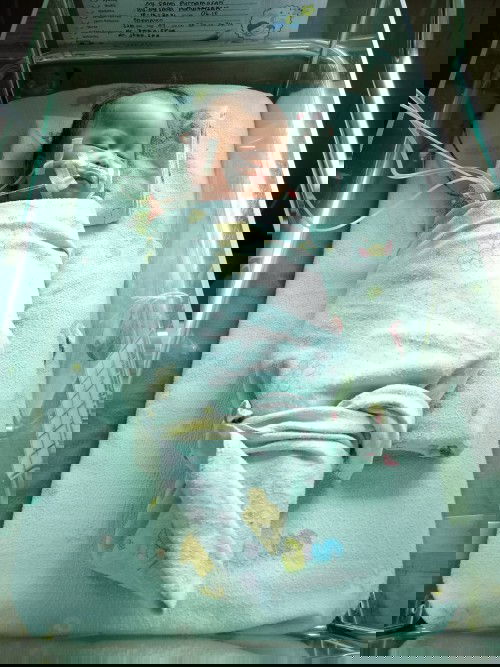 Adakah yg sama butuh masukan anak baby muntah coklat /darah kata dokter infeksi usus