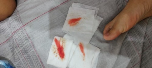 Hello po, 1st time mom po 13weeks and 2days pregnant