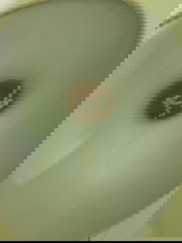 White thick discharge