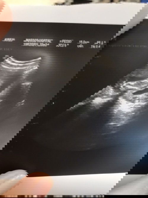 เพศหญิงกี่ % ?