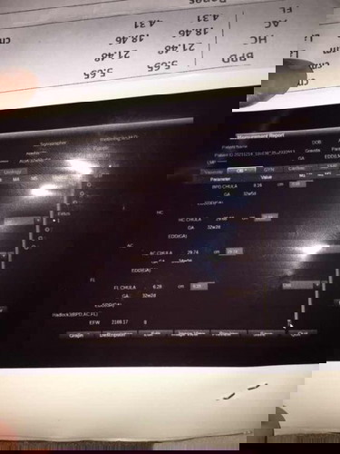 ขอสอบถามแม่ๆหน่อยค่ะ