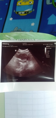 Hasil tes 5 w apa boleh HB dgn suami?