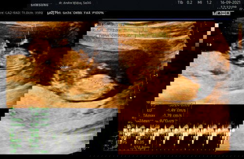 Sekedar sharing ya bunda2 🥰