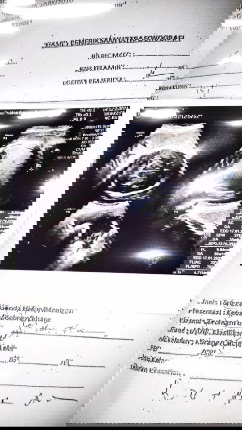 KU KIRA CIRI JANIN MASUK PANGGUL, TERNYATA PLACENTA PREVIA